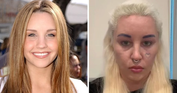 Amanda Bynes Breakdown: Hollywood’s Child Star Failure Exposed